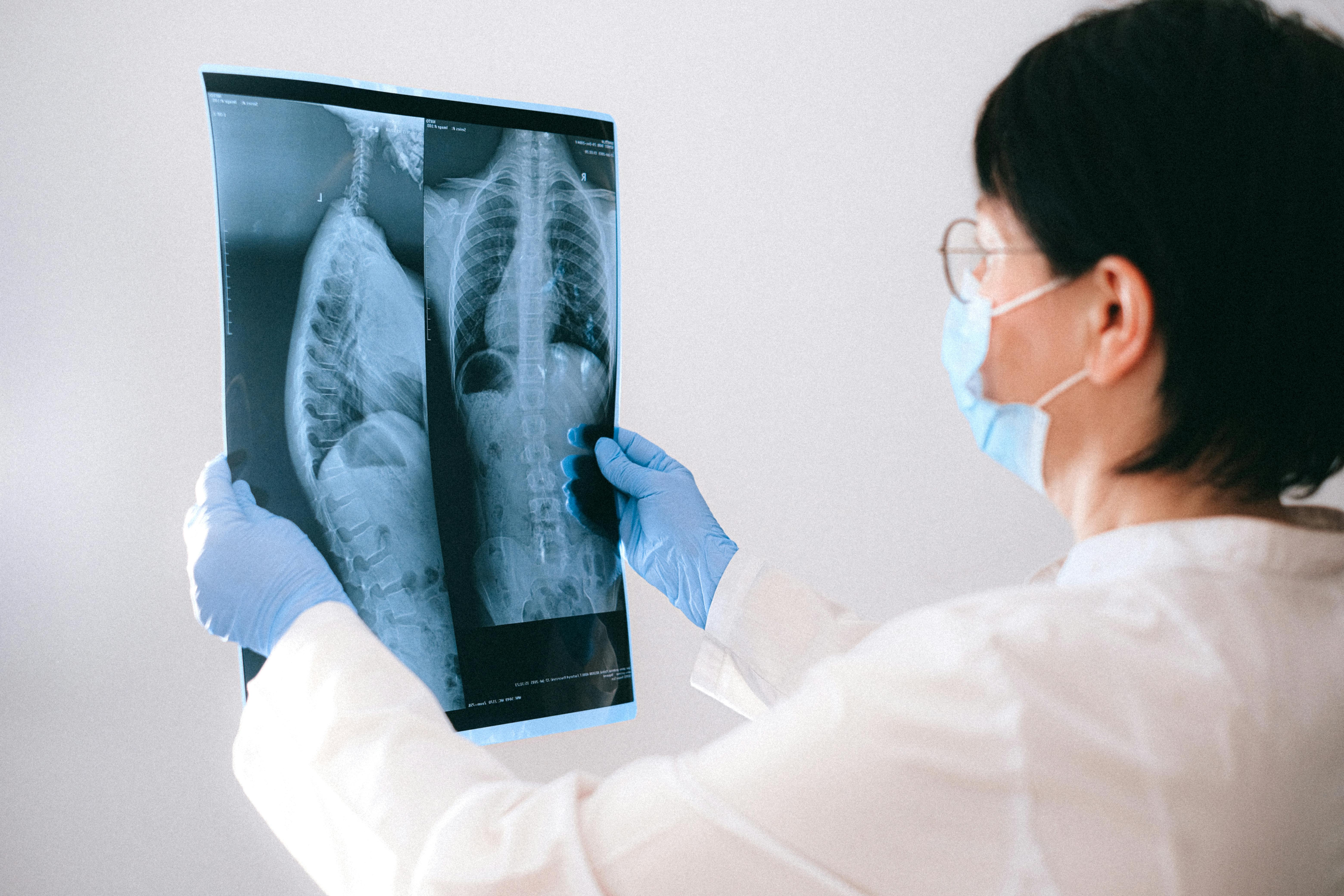 Medical practitioner examining an X-ray of the lung