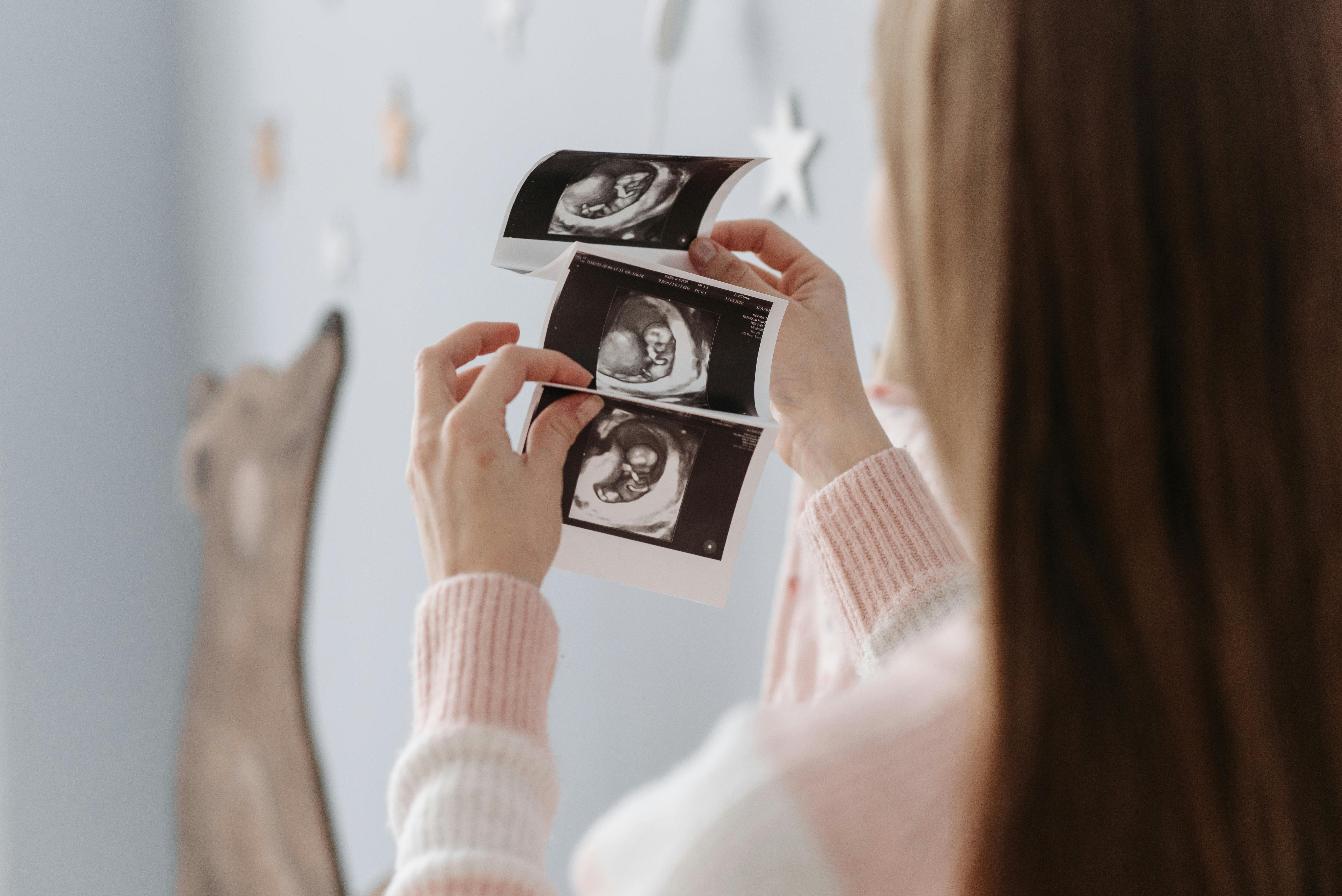 Pregnant woman holding and examining ultrasound scan images in her hands