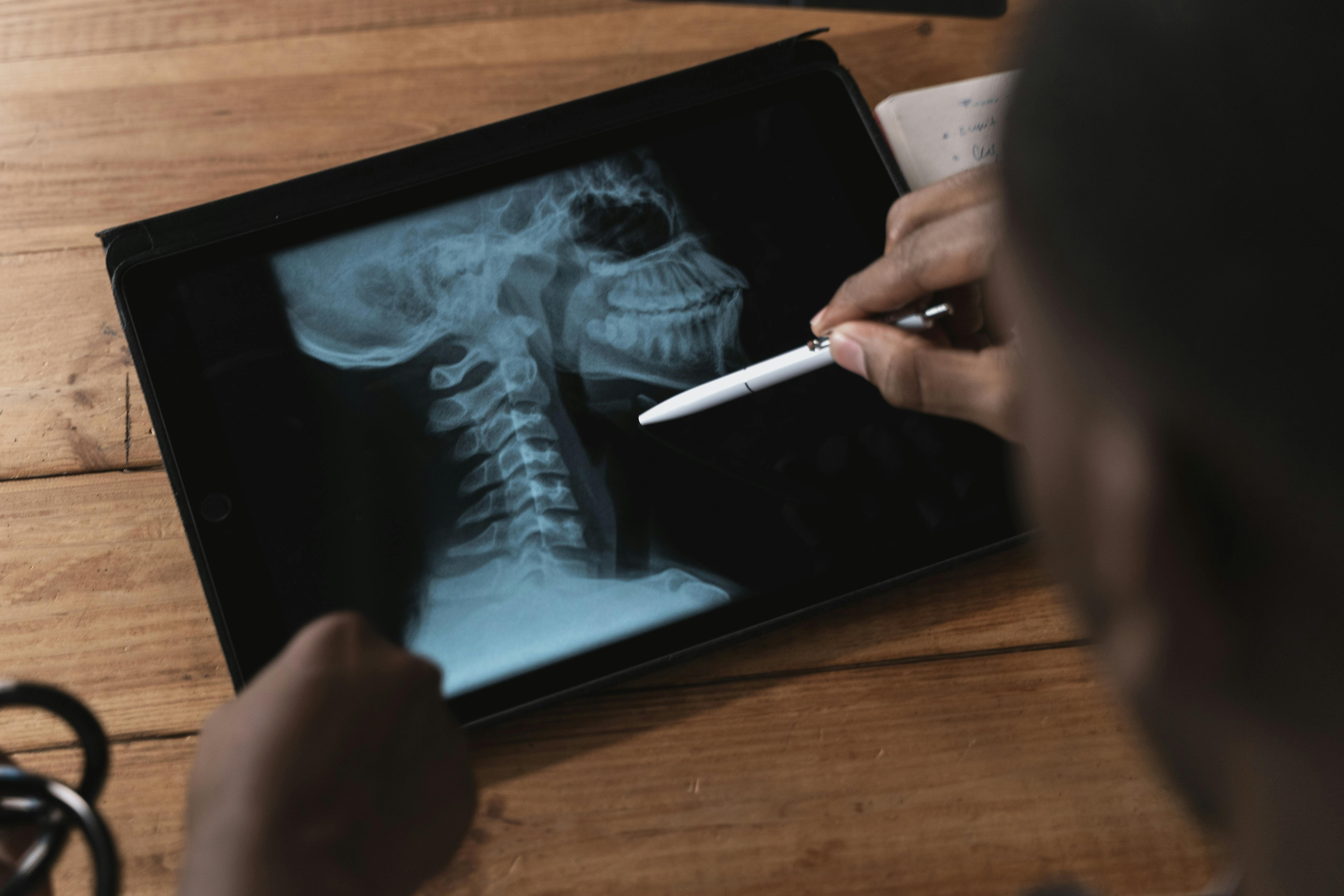 Medical professional showing a patient an X-ray of their head and neck.