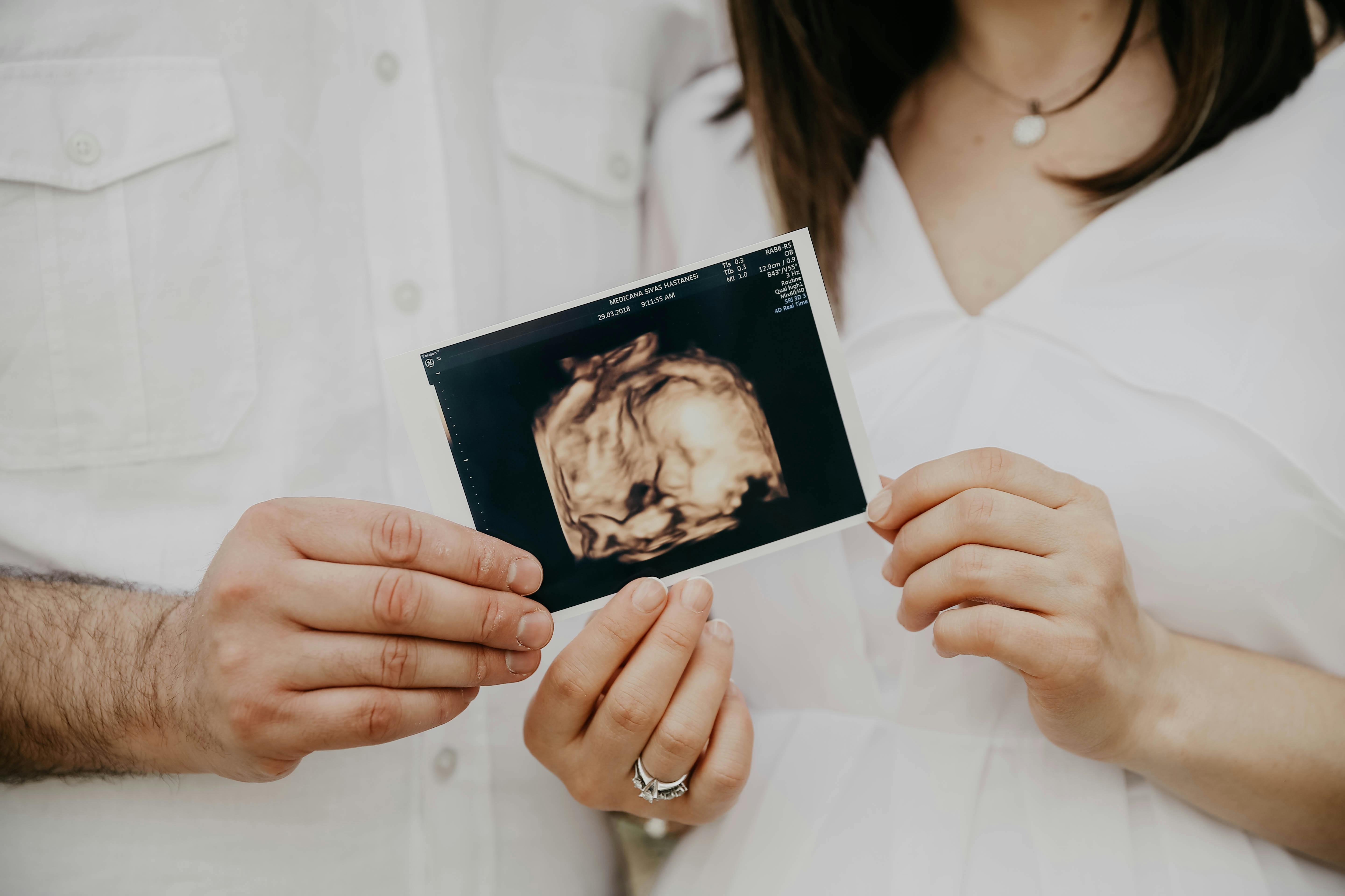 Happy couple holding a 3D ultrasound image.