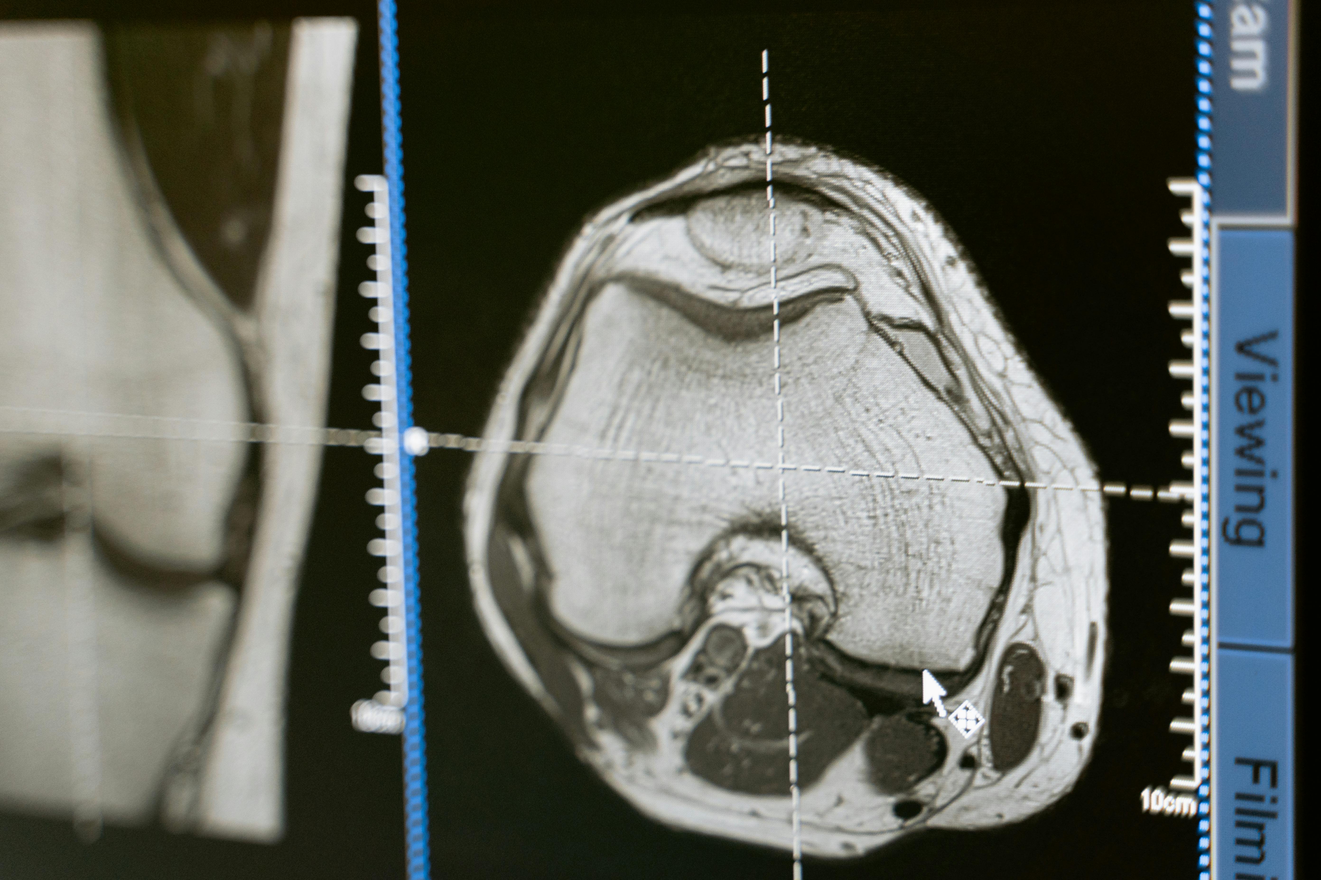 MRI image of part of a leg