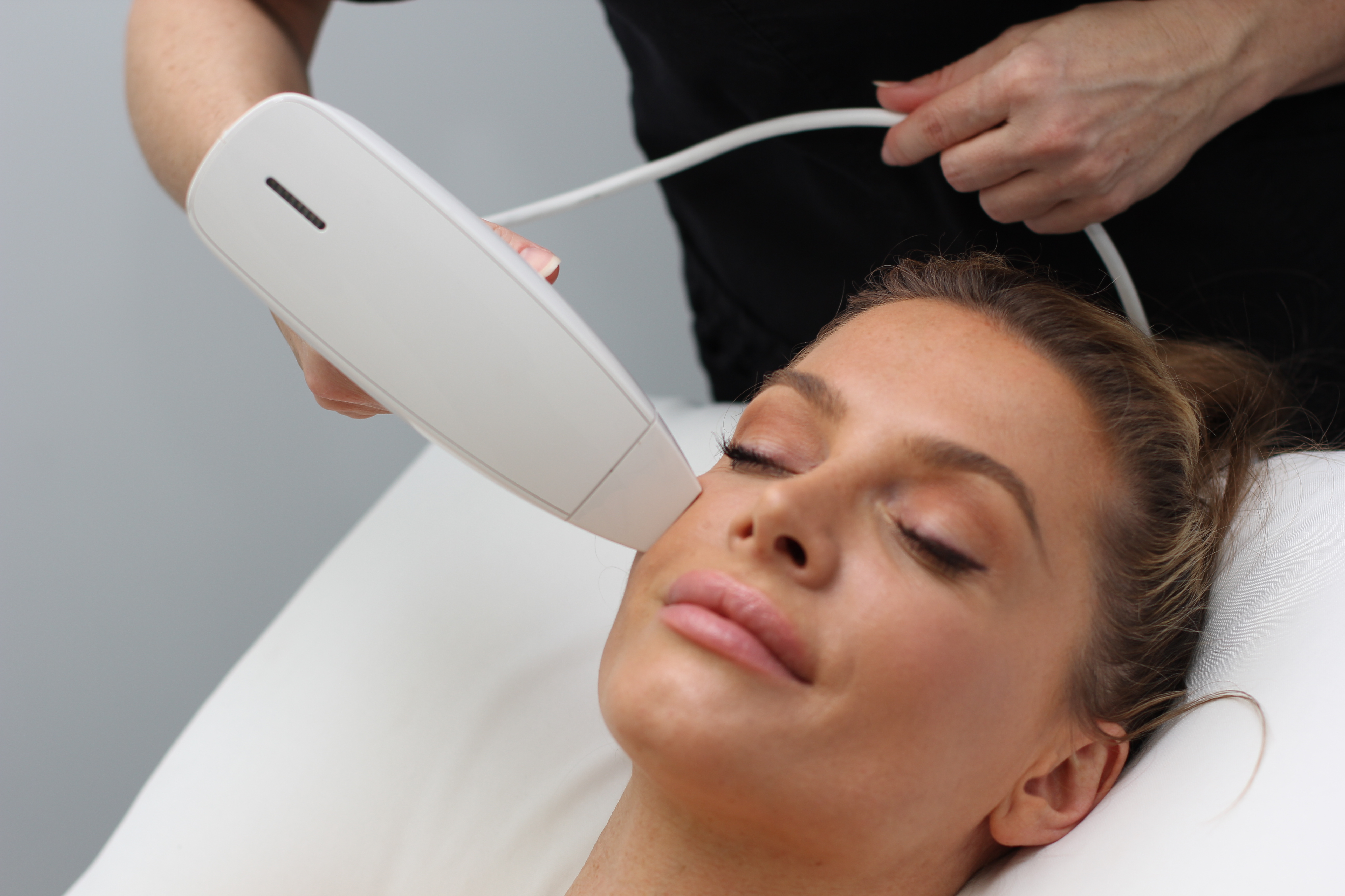 Venus Viva treatment at Beaufort Skin Clinic