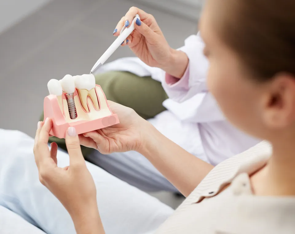 The Ultimate Guide to Dental Implants in Tampa, FL