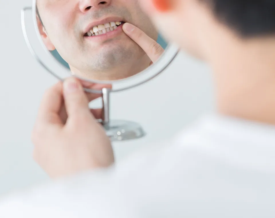 5 Signs You Might Be a Good Candidate for Dental Implants in Tampa