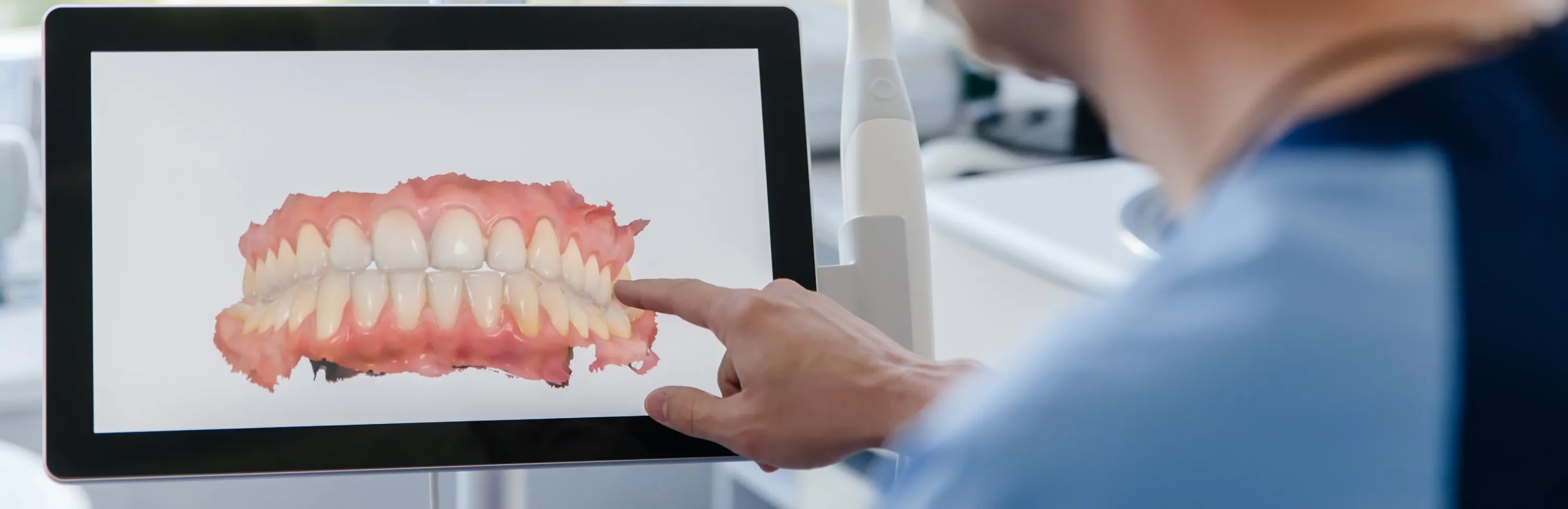 How Advanced 3D Technology Makes Getting Dental Implants Easier in Tampa