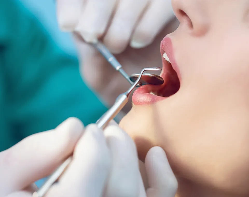 What Happens During a Professional Teeth Cleaning at Signature Smiles of Tampa?