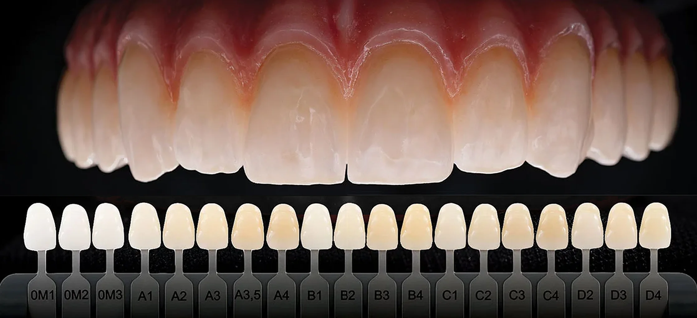 All-on-4 & All-on-6 Dental Implants in Tampa: Restore Your Full Smile in a Single Day