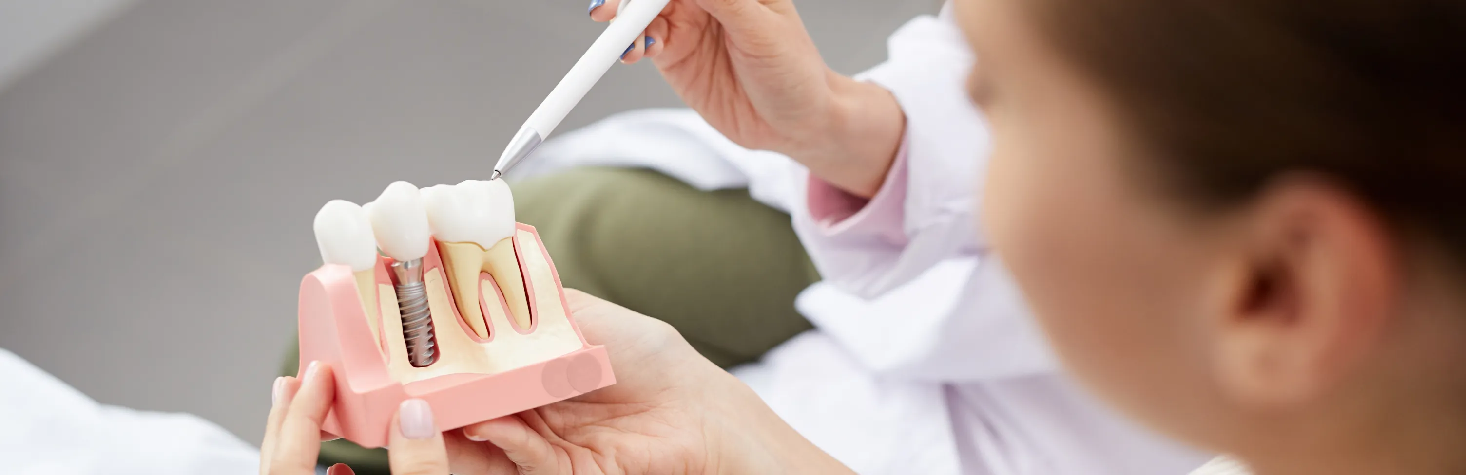All-on-4 Dental Implants for Riverview, FL Patients