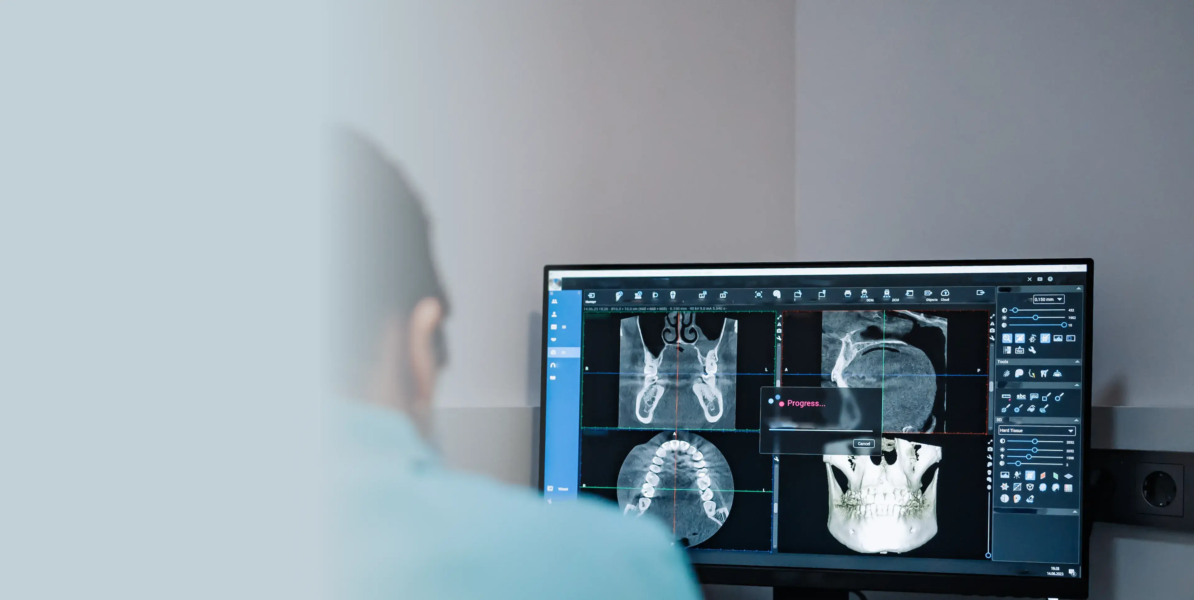 A person looks at skull scans on a computer screen.