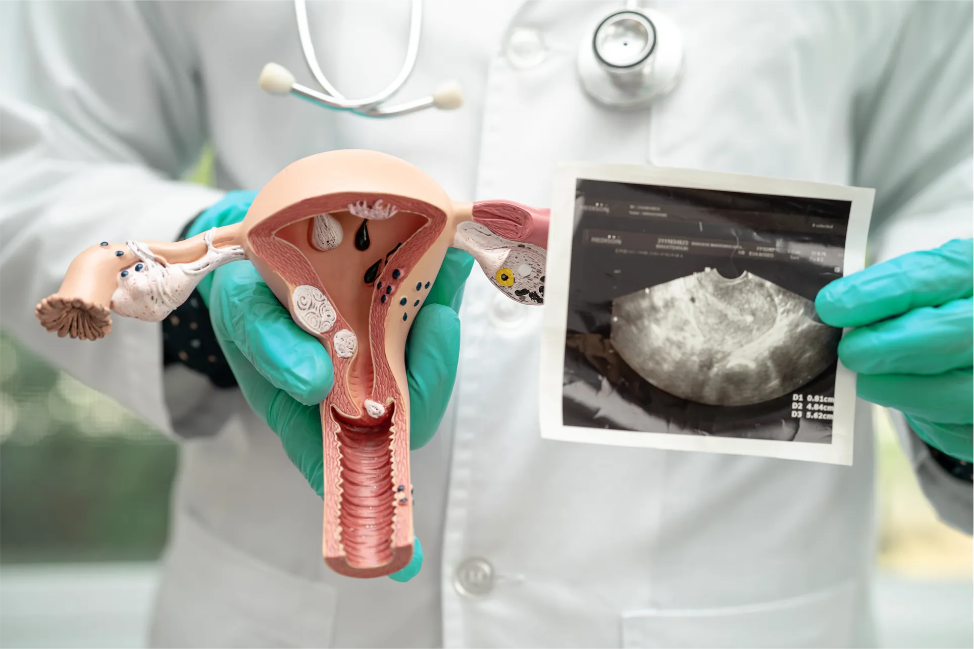 a close up of ovary mock up