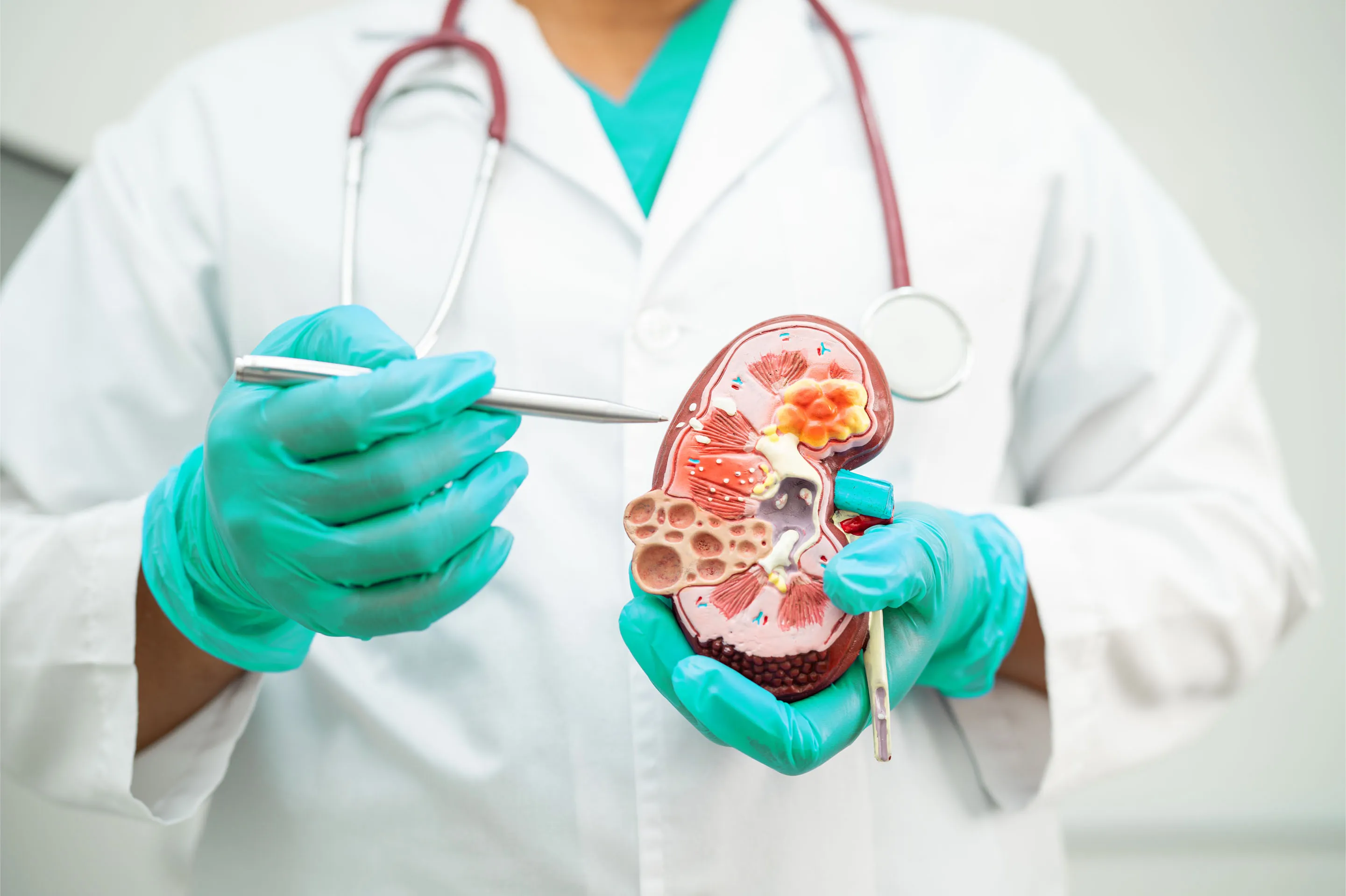 nephrologist pointing at a mock up of a kidney
