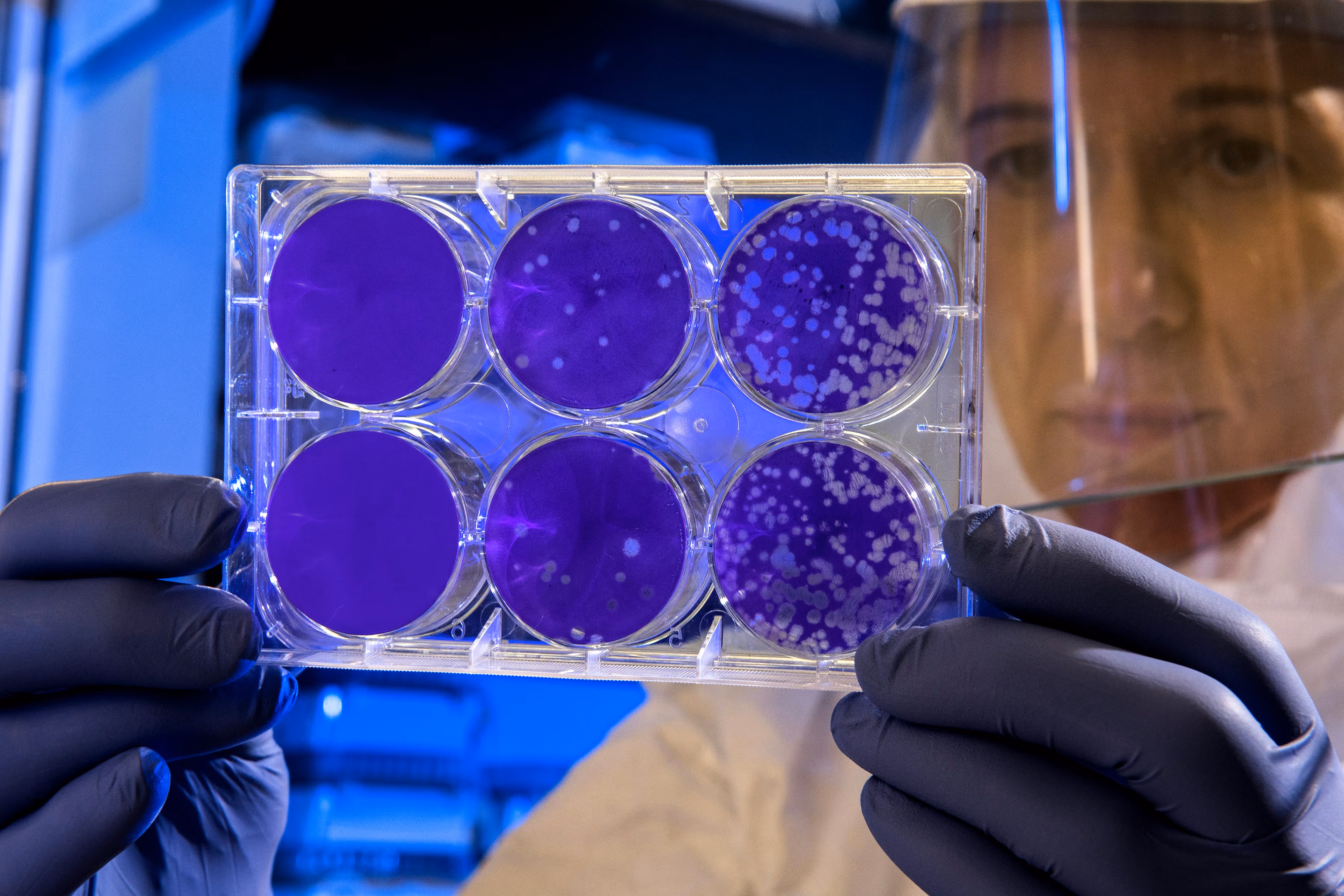 A researcher in a face shield examining a multi-well culture plate