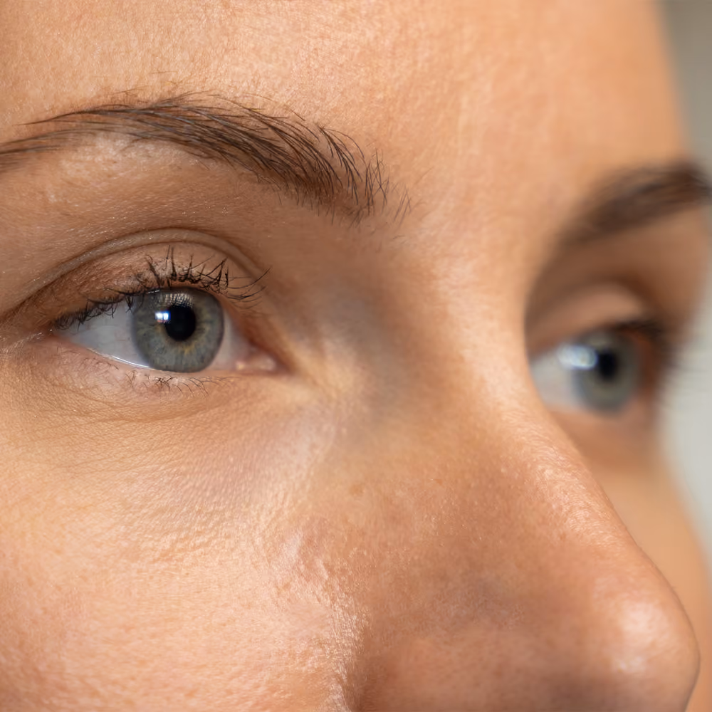 Nahaufnahme von Auge und Augenbraue – Präzise Augen- und Lidchirurgie von Dr. med. Markus Mulica zur Wiederherstellung des frischen Blicks.