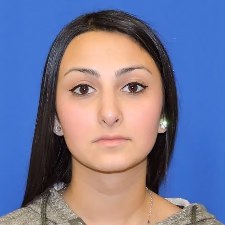 Rhinoplasty after photo, case 2877 - Cool Springs Plastic Surgery