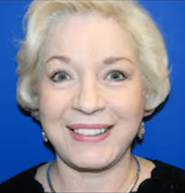 Facelift after photo, case 2483 - Cool Springs Plastic Surgery