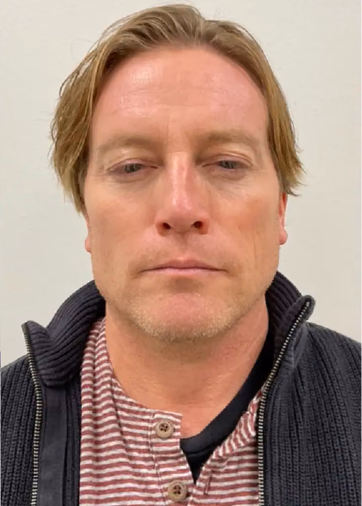 Botox before and after, case 15774 - Cool Springs Plastic Surgery