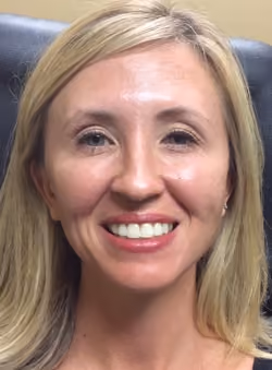 Botox before and after, case 2190 - Cool Springs Plastic Surgery