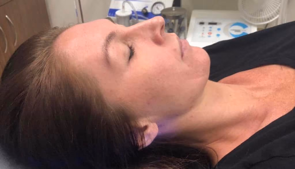 HydraFacial before and after, case 11445 - Cool Springs Plastic Surgery