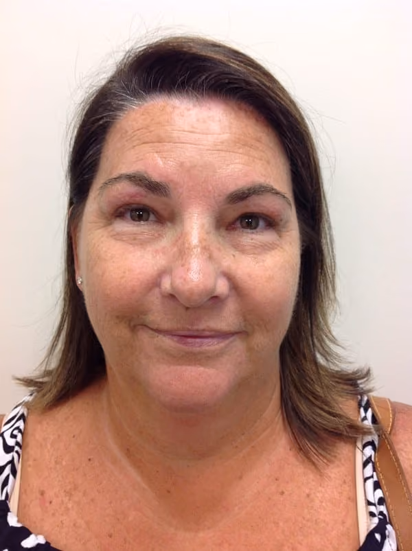 Medical-Grade Skincare before and after, case 6359 - Cool Springs Plastic Surgery