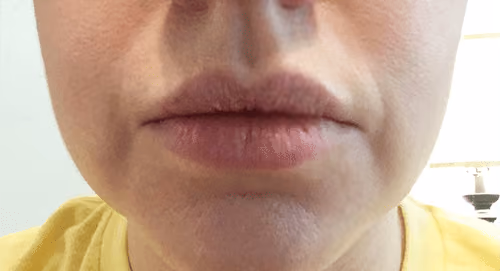Medical-Grade Skincare before and after, case 6871 - Cool Springs Plastic Surgery