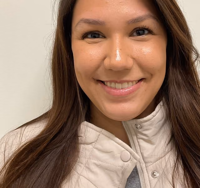 Botox before photo, glabella frown lines — Case 94, Cool Springs Plastic Surgery, Brentwood TN