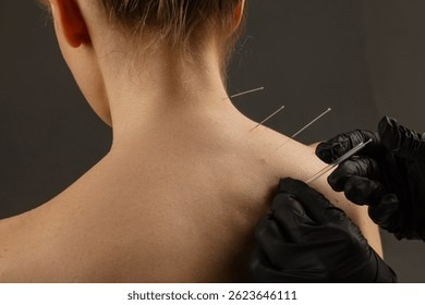 blog-image