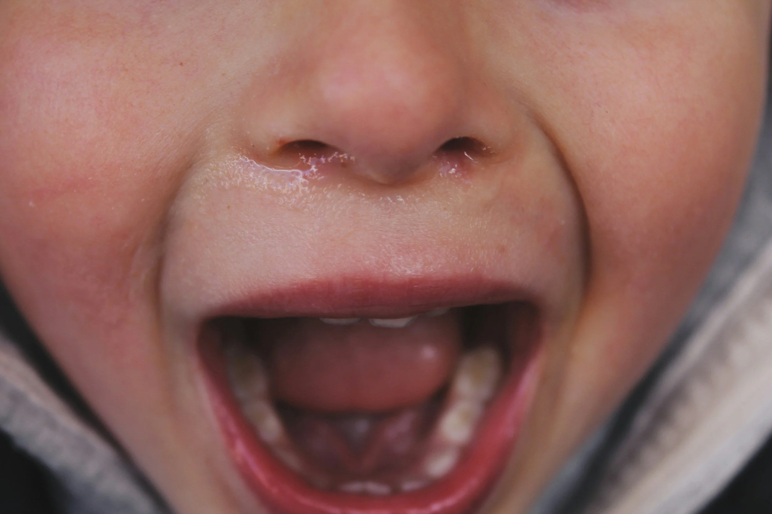 Close-up of a young child's open mouth showing gaps where baby teeth have come out