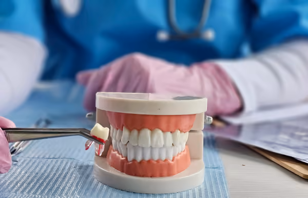 Extractions