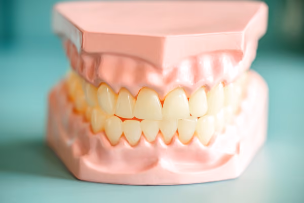 Full dentures