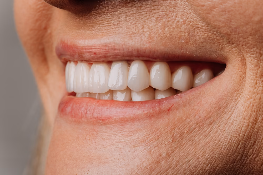How Dental Implants Improve Chewing and Speech