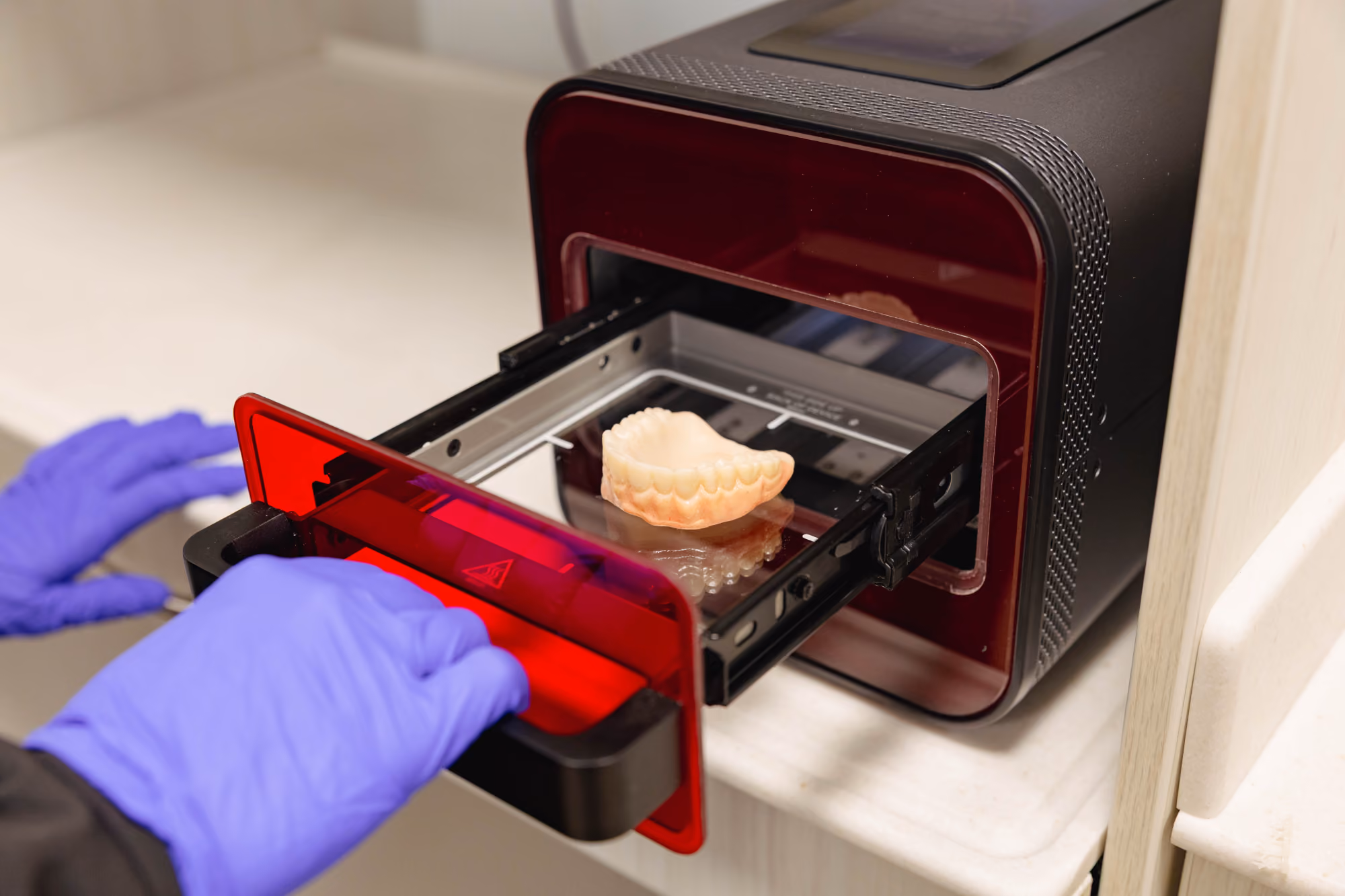 Close-up of gloved hands operating a 3D printer with a dental mold on the build plate inside the printer.