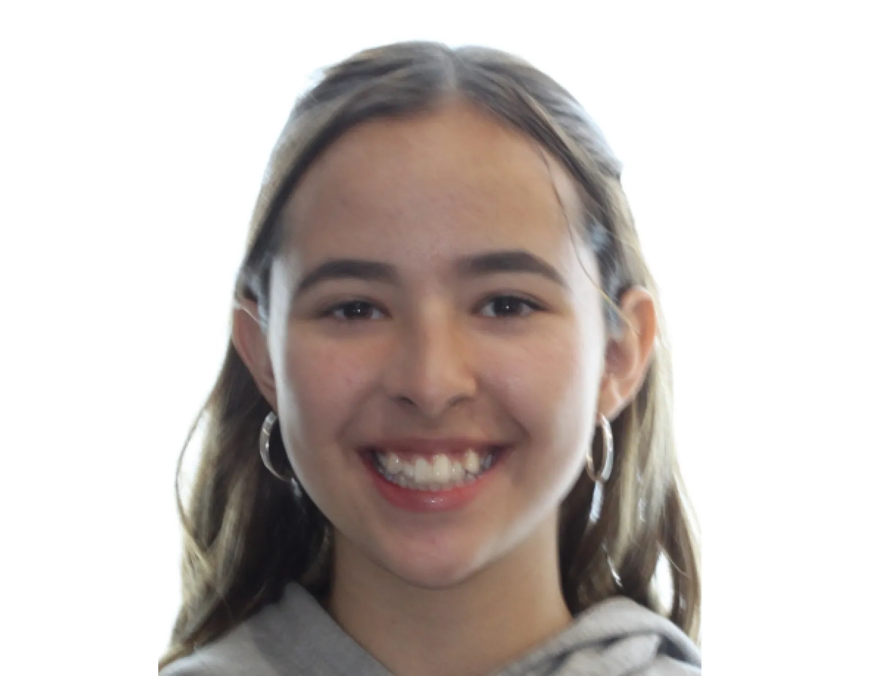 Before orthodontic treatment at Cardall Orthodontics