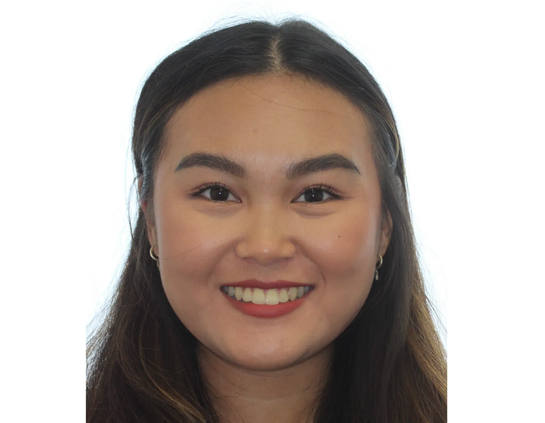 After orthodontic treatment at Cardall Orthodontics