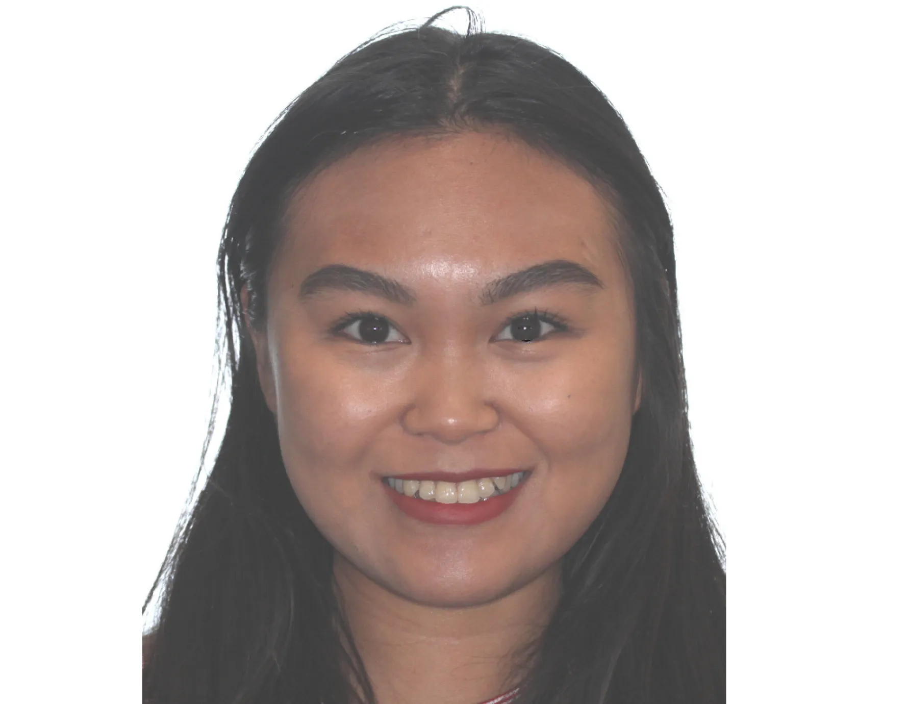 Before orthodontic treatment at Cardall Orthodontics