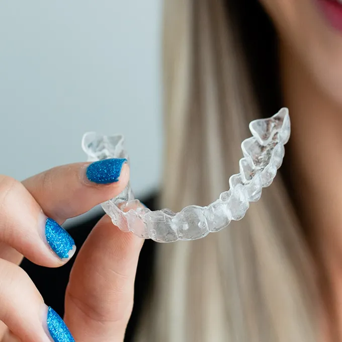 Close-up of a hand with glittery blue nails holding a clear dental aligner, with a woman’s blurred face and hair in the background.