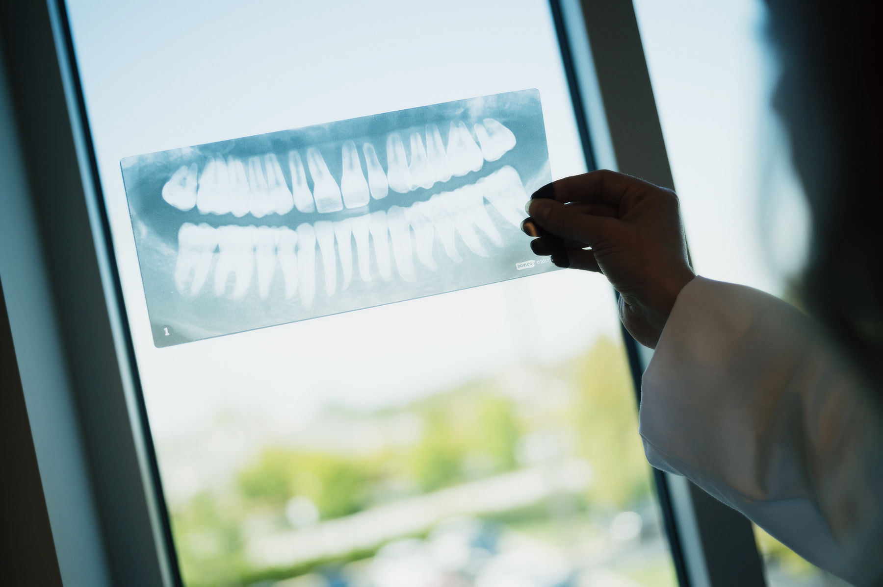 Dentist reviewing a dental X-ray against a window