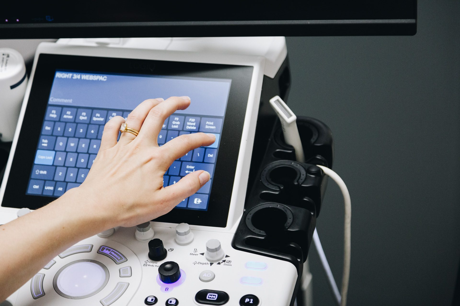 Sonographer operating the ultrasound console during a musculoskeletal scan