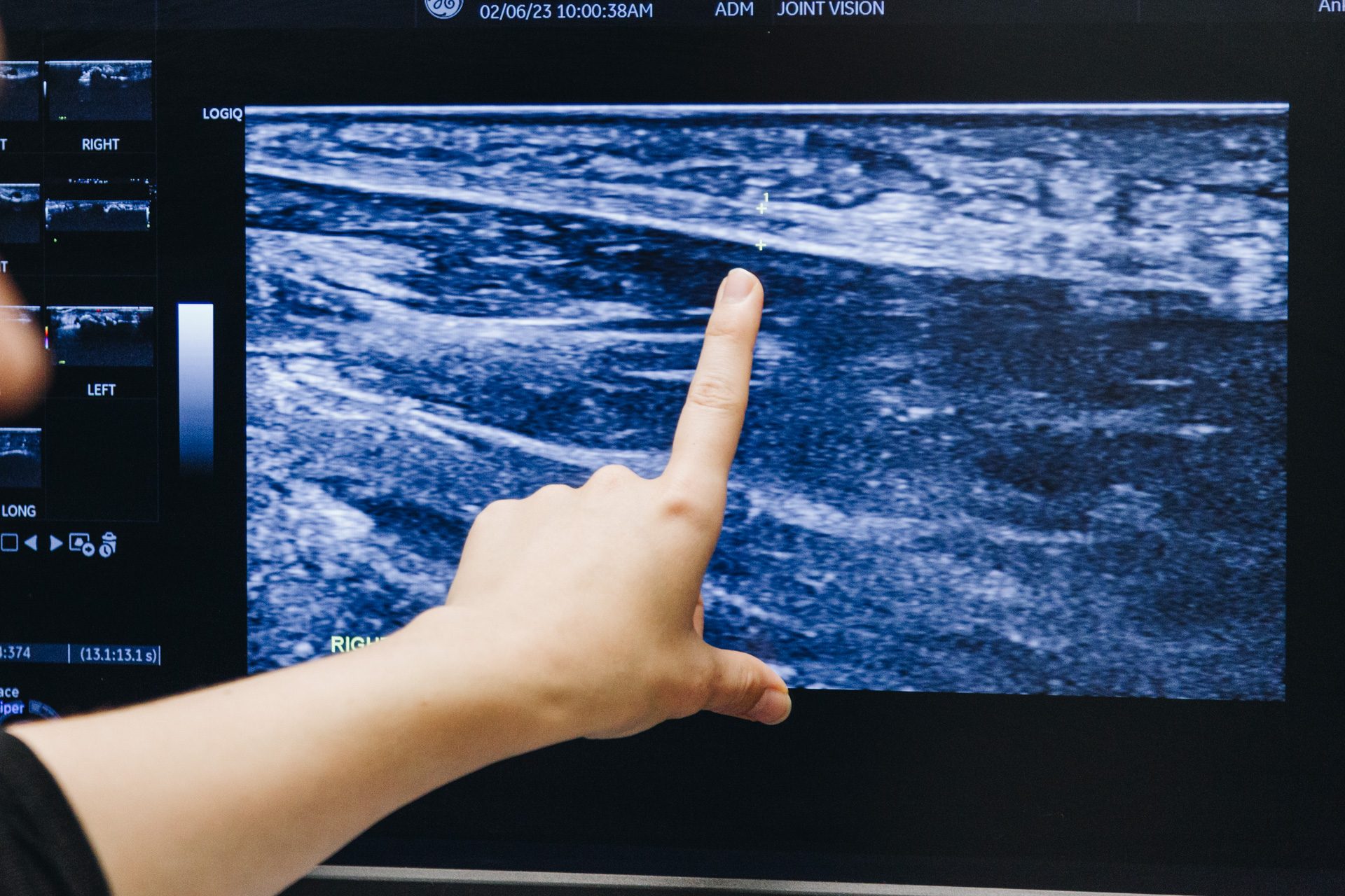Sonographer reviewing a musculoskeletal ultrasound image on screen