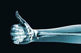 medical imaging xray
