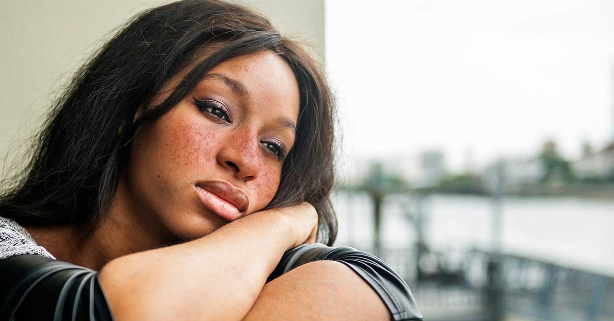 girl-lupus