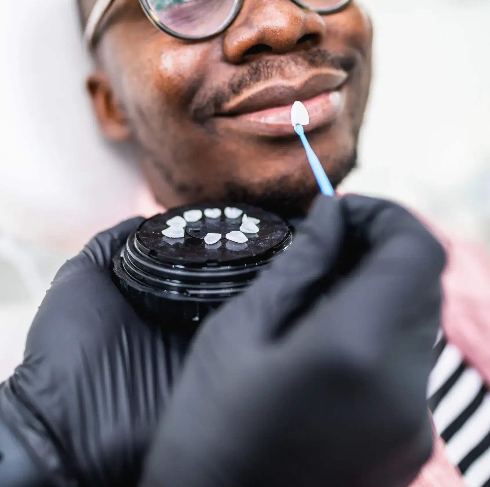 Close-up of a smiling man with glasses holding dental veneers, with a gloved hand applying a veneer near his mouth.