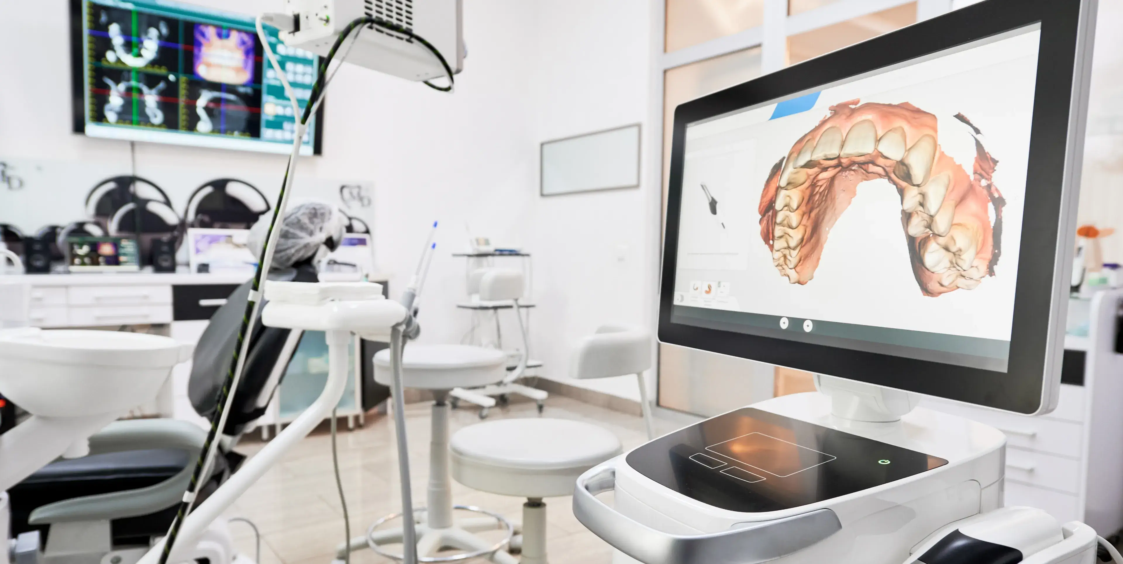 A dental office with a digital screen displaying a 3D model of teeth.