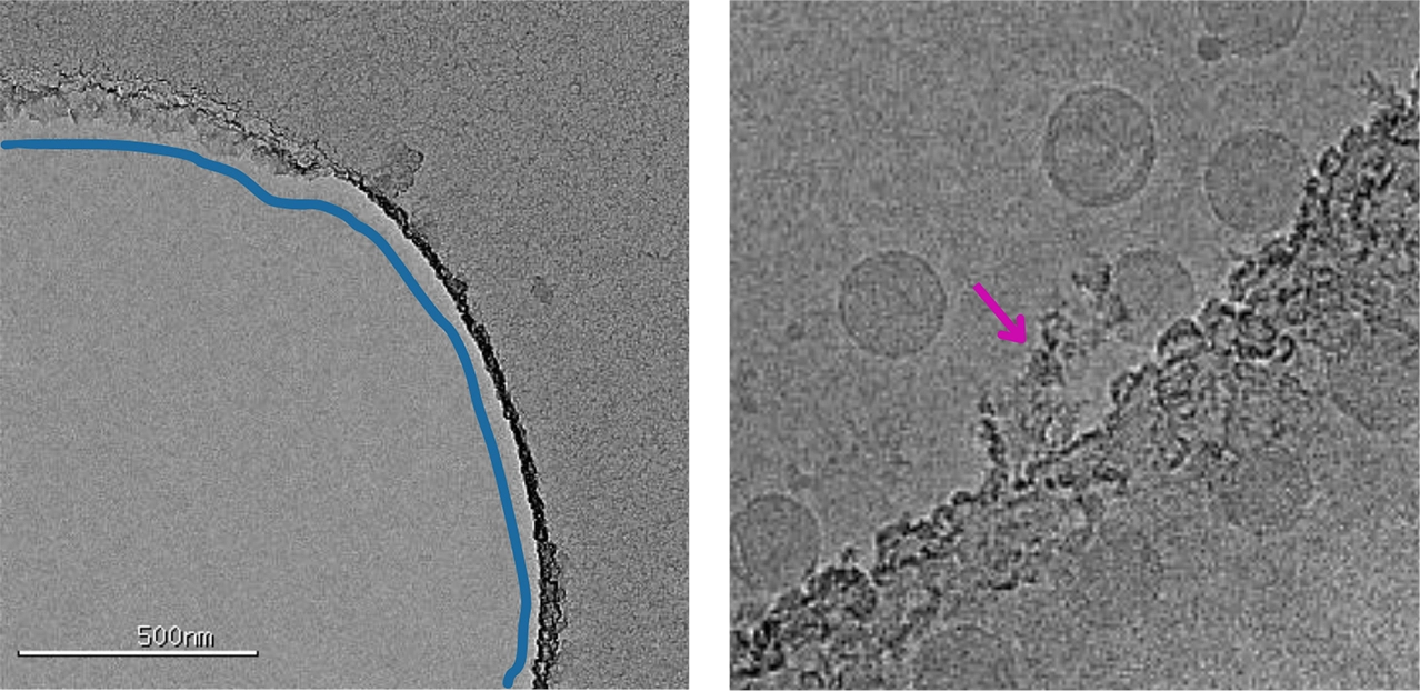 Microscopic black and white image of cryo-TEM carbon grid imperfections imaging | nanoparticle characterization at nanoimaging services