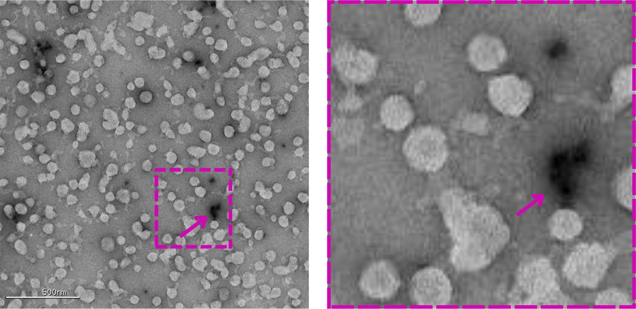 Microscopic black and white image of ngatie stain TEM stain crystal clusters  imaging | nanoparticle characterization at nanoimaging services