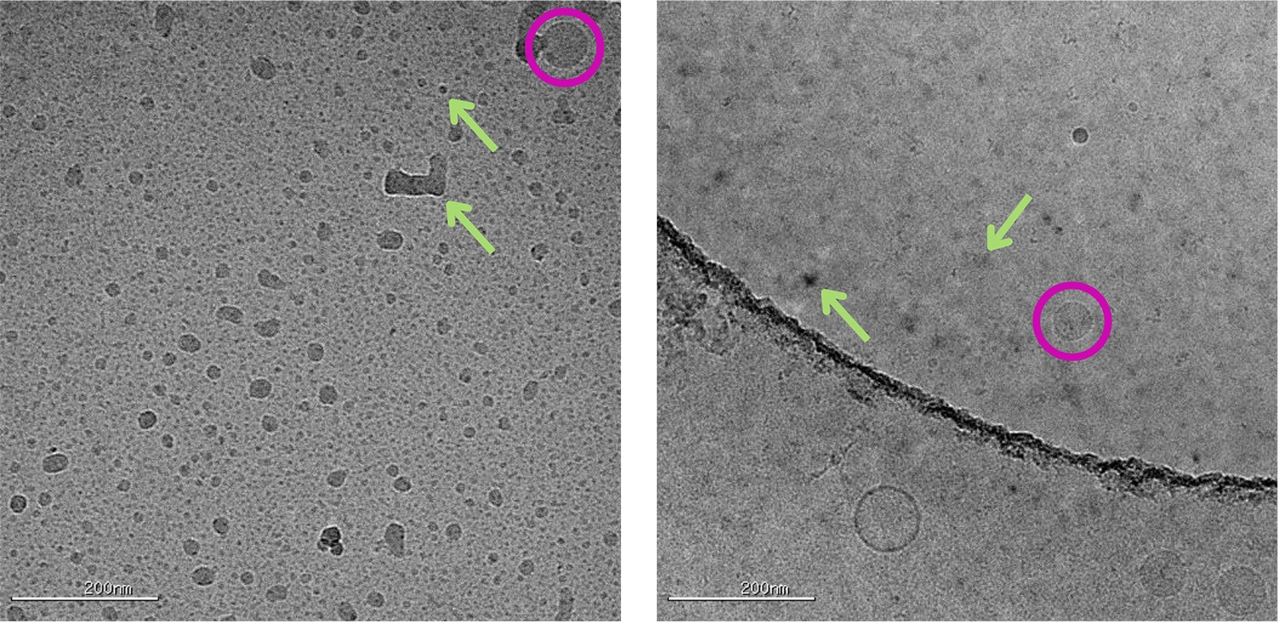 Microscopic black and white image of cryo-TEM crystalline ice contamination imaging | nanoparticle characterization at nanoimaging services