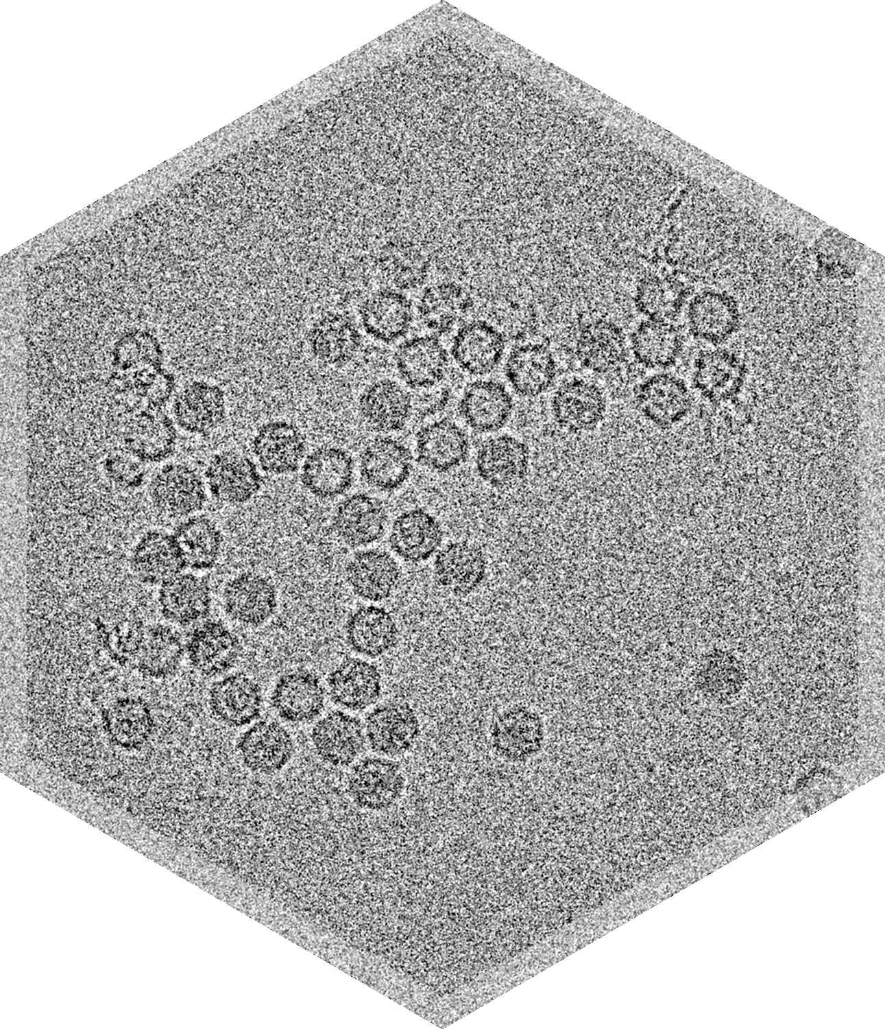 lack and white image of adeno-associated virus taken with transmission electron microscopy