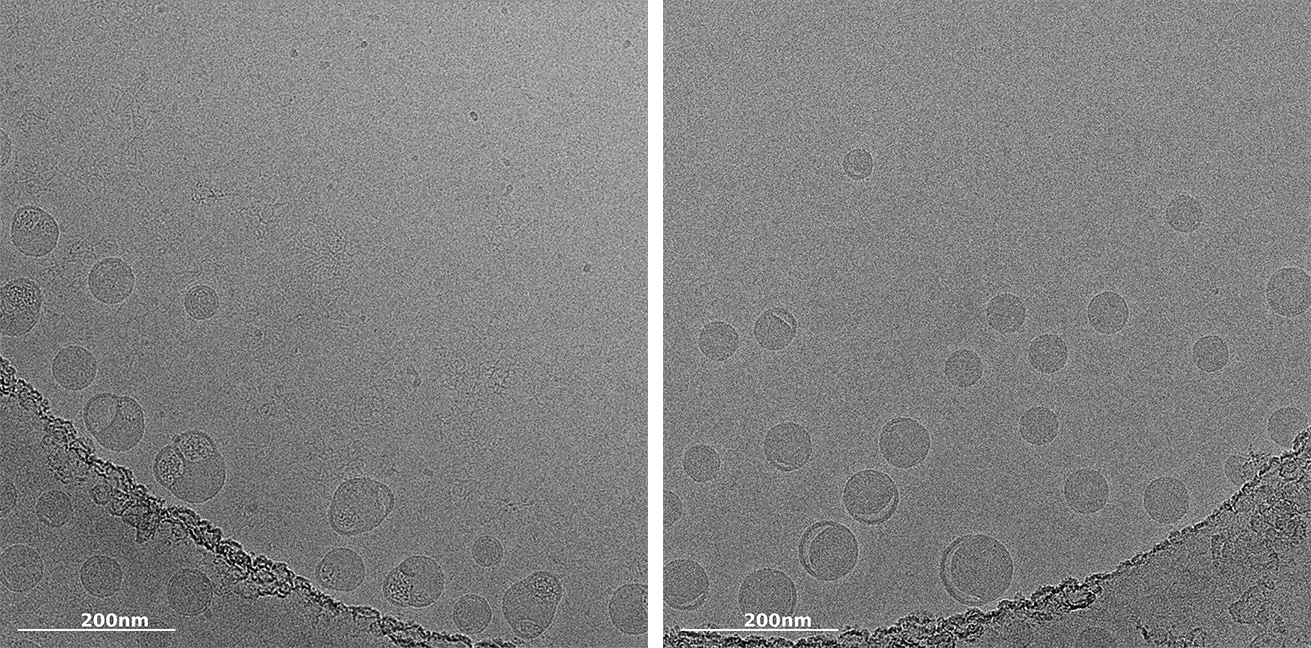 Microscopic image of mrna loaded lipid nanoparticle characterization by cryo-tem by nano imaging services