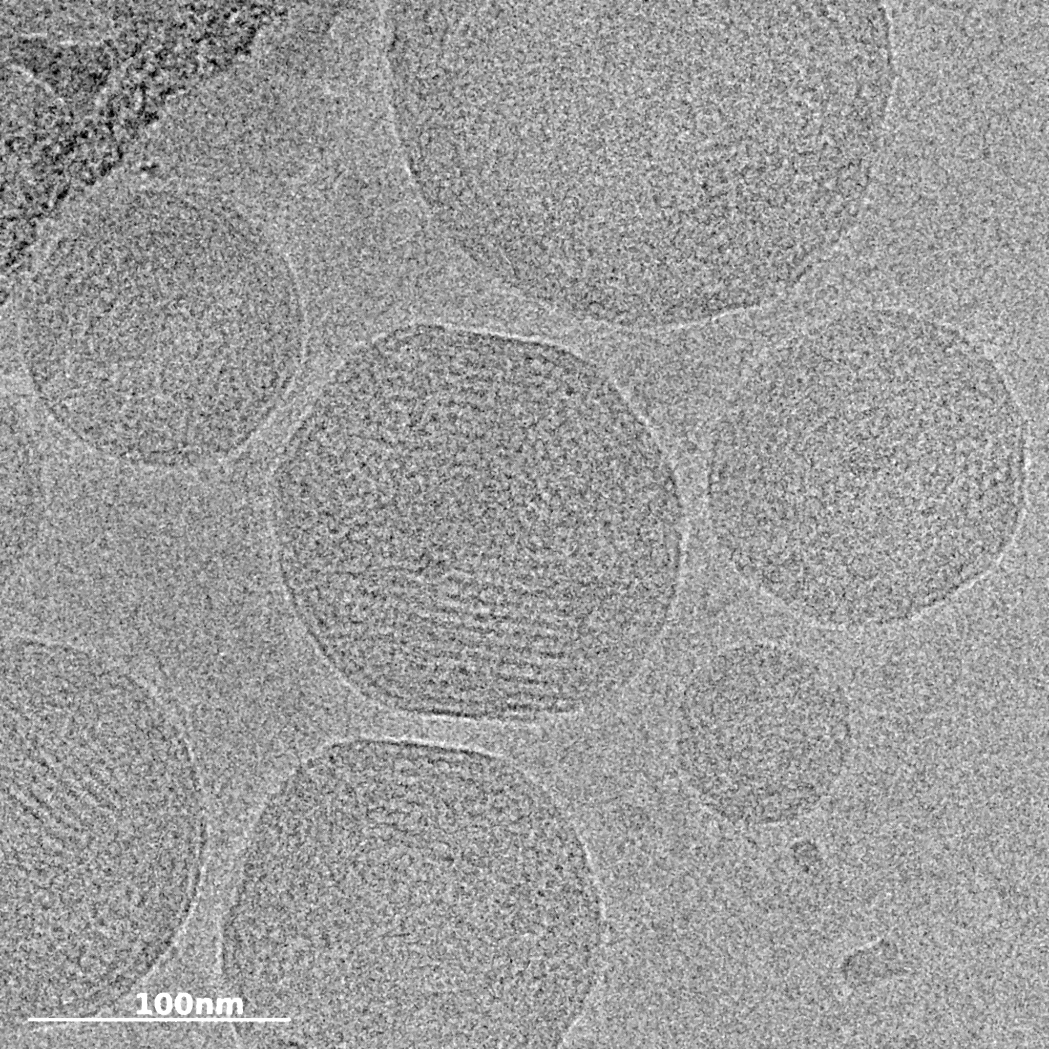 Black and white image of cryo-tem image of lnp characterization analysis encapsulation efficiency dna encapsulation payload distribution | lipid nanoparticle characterization | nano imaging