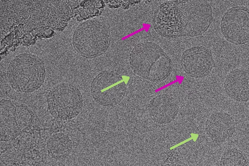 Seeing the Building Blocks: Direct Imaging of Payload Distribution of DNA and RNA in Lipid Nanoparticles