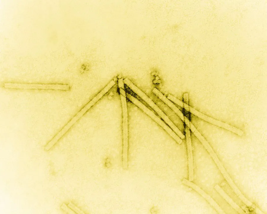 The Cutting Edge of Imaging: How Transmission Electron Microscopy Continues to Advance Research